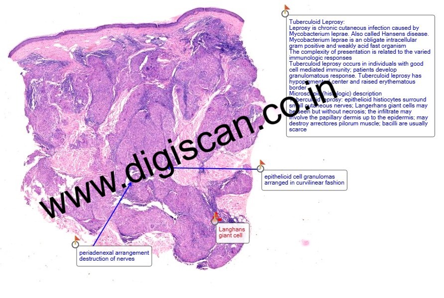 Dermatopathology Digital Slides Set (Skin Lesions, Infections & Tumors)
